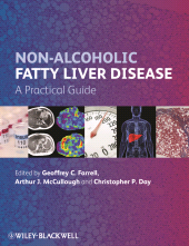 E-book, Non-Alcoholic Fatty Liver Disease : A Practical Guide, Blackwell