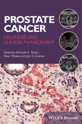 E-book, Prostate Cancer : Diagnosis and Clinical Management, Blackwell