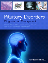 eBook, Pituitary Disorders : Diagnosis and Management, Blackwell