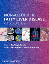 E-book, Non-Alcoholic Fatty Liver Disease : A Practical Guide, Blackwell