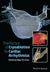 eBook, The Practice of Catheter Cryoablation for Cardiac Arrhythmias, Blackwell