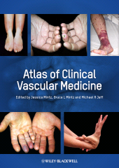 E-book, Atlas of Clinical Vascular Medicine, Blackwell