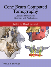 E-book, Cone Beam Computed Tomography : Oral and Maxillofacial Diagnosis and Applications, Blackwell