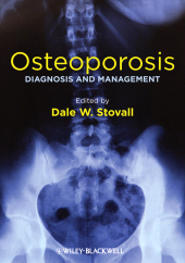 eBook, Osteoporosis : Diagnosis and Management, Blackwell