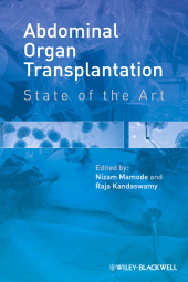 E-book, Abdominal Organ Transplantation : State of the Art, Wiley