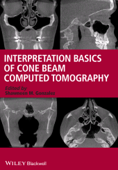 E-book, Interpretation Basics of Cone Beam Computed Tomography, Wiley