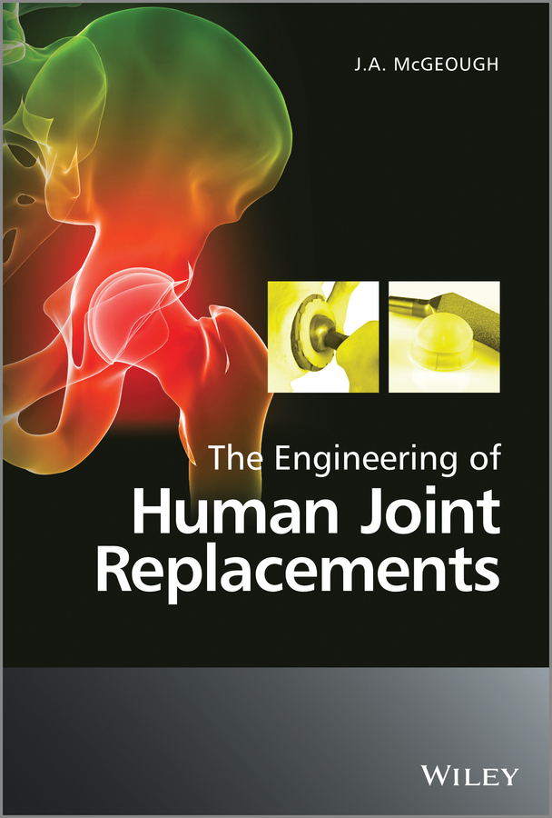 E-book, The Engineering of Human Joint Replacements, John Wiley & Sons