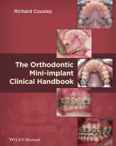 E-book, The Orthodontic Mini-implant Clinical Handbook, John Wiley & Sons