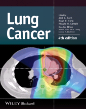 eBook, Lung Cancer, Blackwell