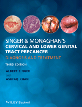 E-book, Singer and Monaghan's Cervical and Lower Genital Tract Precancer : Diagnosis and Treatment, Blackwell