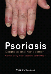 E-book, Psoriasis : Diagnosis and Management, Blackwell