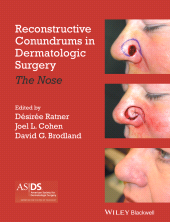 E-book, Reconstructive Conundrums in Dermatologic Surgery : The Nose, Blackwell