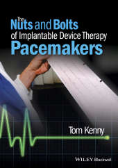 eBook, The Nuts and Bolts of Implantable Device Therapy : Pacemakers, Blackwell