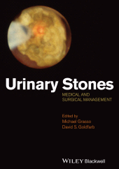 eBook, Urinary Stones : Medical and Surgical Management, Blackwell