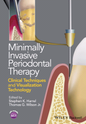 E-book, Minimally Invasive Periodontal Therapy : Clinical Techniques and Visualization Technology, Blackwell