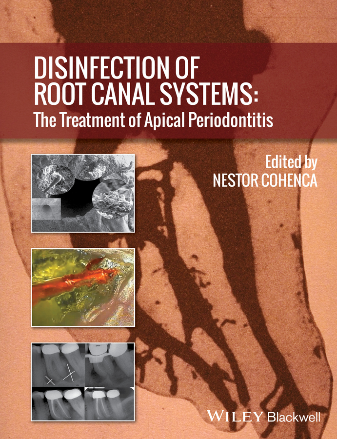 eBook, Disinfection of Root Canal Systems : The Treatment of Apical Periodontitis, Blackwell