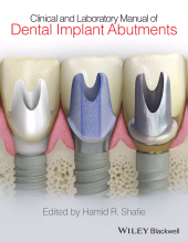 eBook, Clinical and Laboratory Manual of Dental Implant Abutments, Blackwell