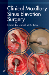 E-book, Clinical Maxillary Sinus Elevation Surgery, Blackwell