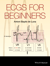 eBook, ECGs for Beginners, Blackwell