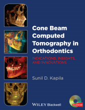 E-book, Cone Beam Computed Tomography in Orthodontics : Indications, Insights, and Innovations, Wiley
