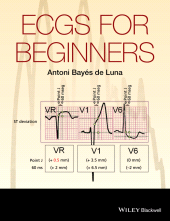 E-book, ECGs for Beginners, Wiley