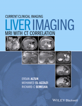 eBook, Liver Imaging : MRI with CT Correlation, Blackwell