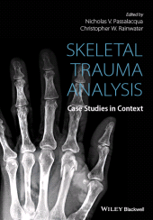 E-book, Skeletal Trauma Analysis : Case Studies in Context, Blackwell