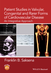 E-book, Patient Studies in Valvular, Congenital, and Rarer Forms of Cardiovascular Disease : An Integrative Approach, Blackwell