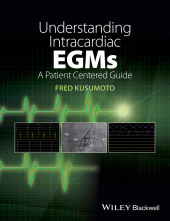 E-book, Understanding Intracardiac EGMs : A Patient Centered Guide, Blackwell