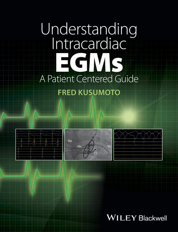 eBook, Understanding Intracardiac EGMs : A Patient Centered Guide, Blackwell