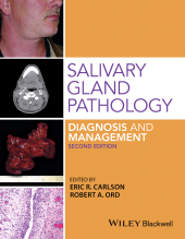 E-book, Salivary Gland Pathology : Diagnosis and Management, Blackwell