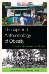 E-book, The Applied Anthropology of Obesity : Prevention, Intervention, and Identity, Lexington Books