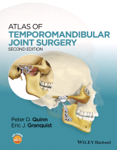 E-book, Atlas of Temporomandibular Joint Surgery, Wiley