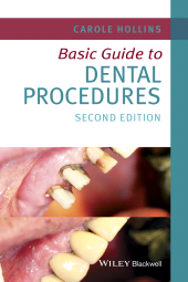 E-book, Basic Guide to Dental Procedures, Wiley