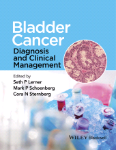 E-book, Bladder Cancer : Diagnosis and Clinical Management, Wiley