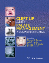 E-book, Cleft Lip and Palate Management : A Comprehensive Atlas, Wiley