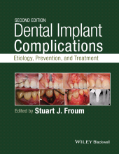 E-book, Dental Implant Complications : Etiology, Prevention, and Treatment, Wiley