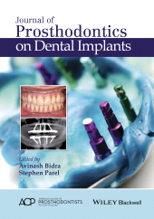 E-book, Journal of Prosthodontics on Dental Implants, Wiley