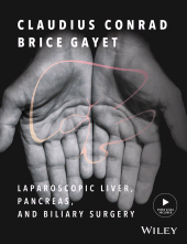 E-book, Laparoscopic Liver, Pancreas, and Biliary Surgery, Blackwell