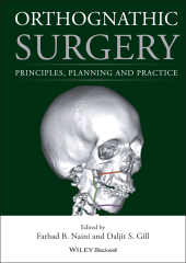 eBook, Orthognathic Surgery : Principles, Planning and Practice, Blackwell