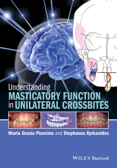 E-book, Understanding Masticatory Function in Unilateral Crossbites, Blackwell