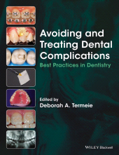 E-book, Avoiding and Treating Dental Complications : Best Practices in Dentistry, Wiley