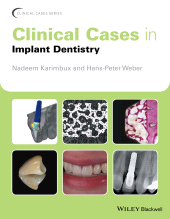 eBook, Clinical Cases in Implant Dentistry, Wiley