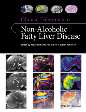 E-book, Clinical Dilemmas in Non-Alcoholic Fatty Liver Disease, Wiley