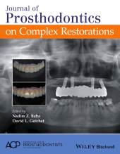 E-book, Journal of Prosthodontics on Complex Restorations, Wiley
