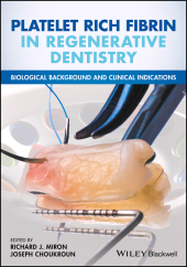 eBook, Platelet Rich Fibrin in Regenerative Dentistry : Biological Background and Clinical Indications, Blackwell