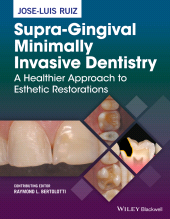 eBook, Supra-Gingival Minimally Invasive Dentistry : A Healthier Approach to Esthetic Restorations, Blackwell
