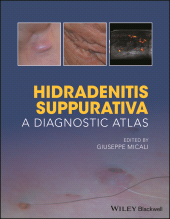 E-book, Hidradenitis Suppurativa : A Diagnostic Atlas, Blackwell