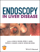 E-book, Endoscopy in Liver Disease, Blackwell