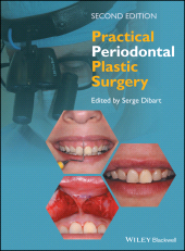 E-book, Practical Periodontal Plastic Surgery, Blackwell